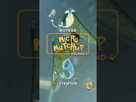Round 4: Who will win? Stentor vs Rotifer